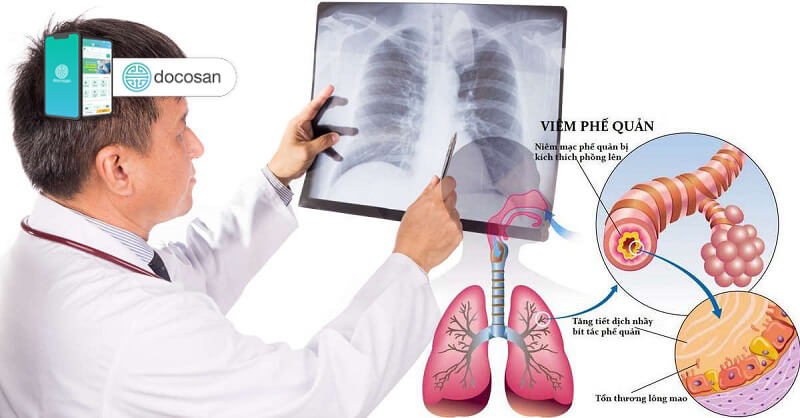 Thông tin dịch bệnh truyền nhiễm lây truyền qua đường hô hấp và khuyến cáo phòng, chống dịch bệnh